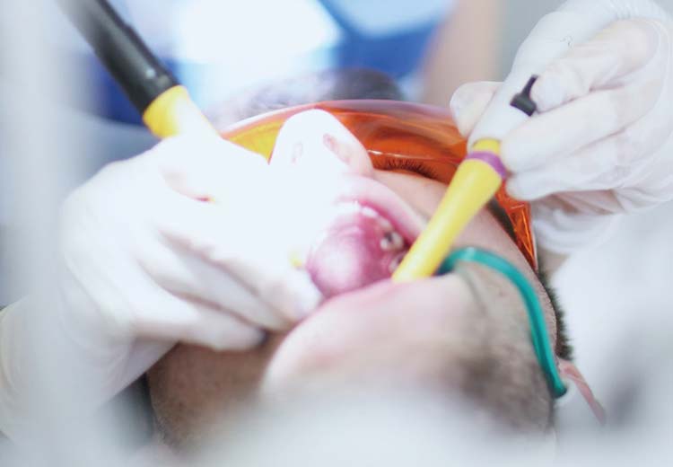 saliva ejectors disposable