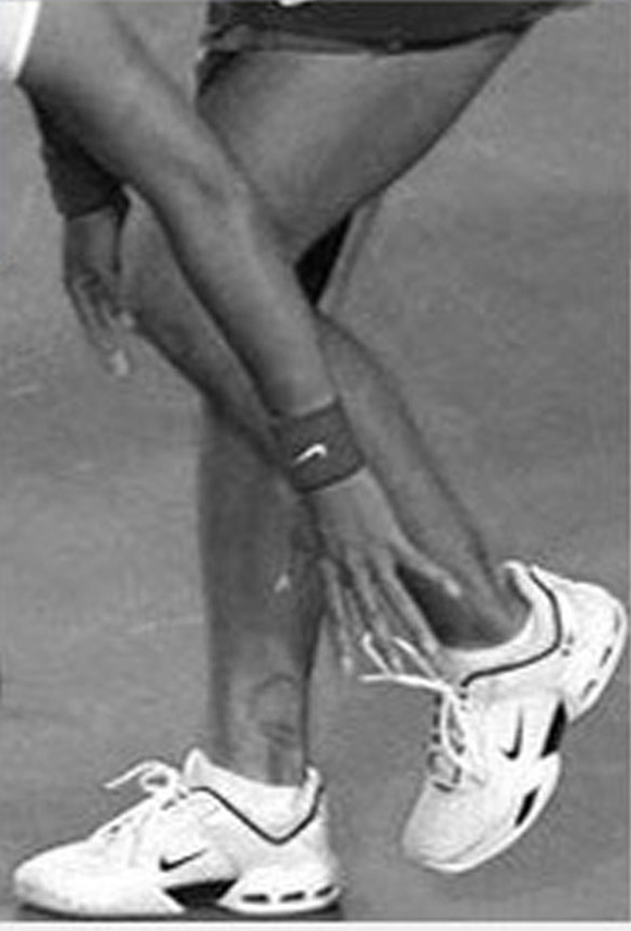 elastic gauze bandage